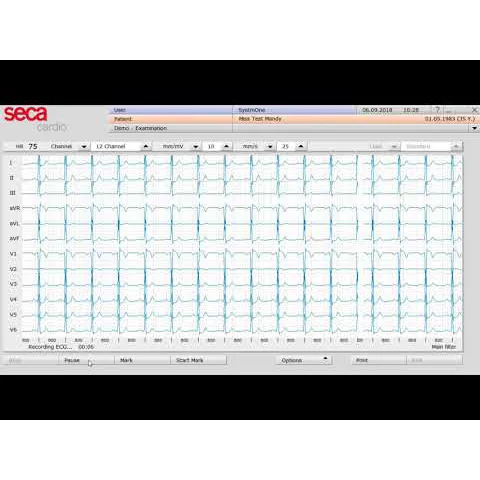 Seca CT321 PC-Based ECG Machine - Bluetooth Version - Image 2