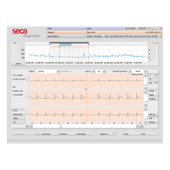 Seca Holter Analysis ECG Sotware