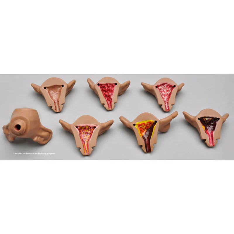 Set of seven uteri for R10183