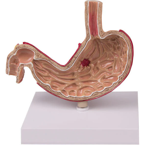 Stomach Model - Life-Size