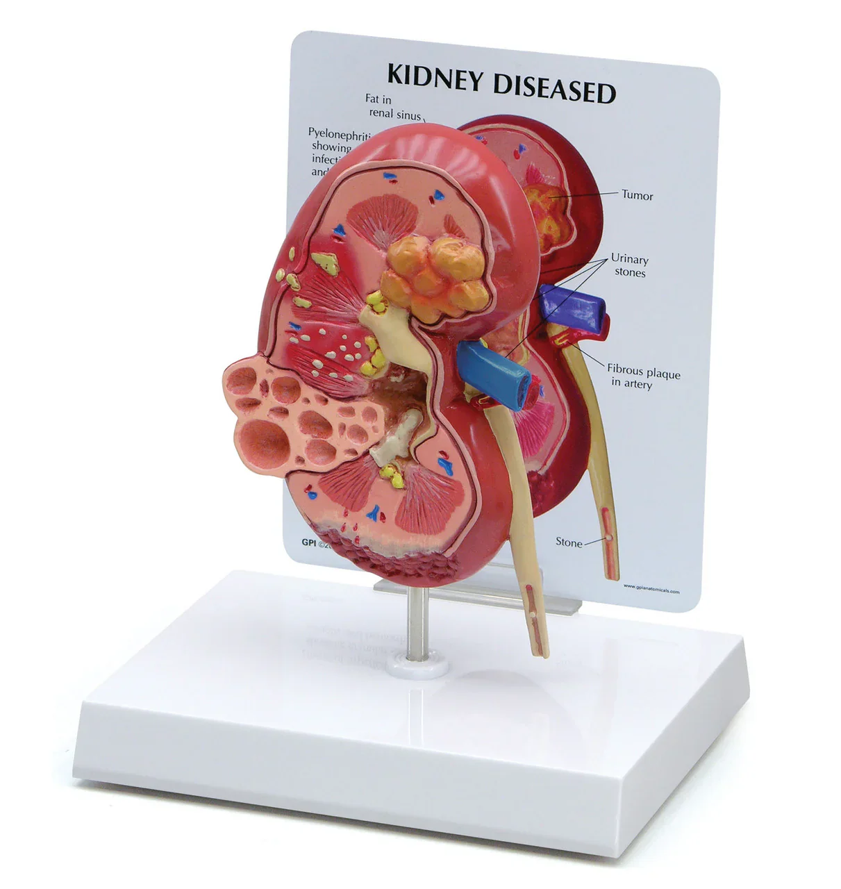 Urinary System Anatomy Collection - Image 7