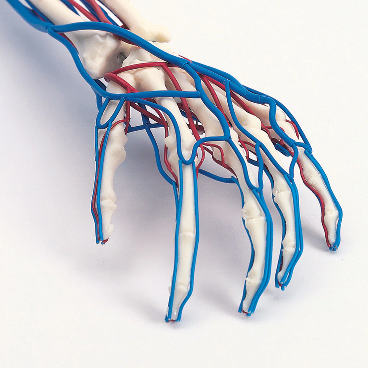 Vascular Arm - Image 2