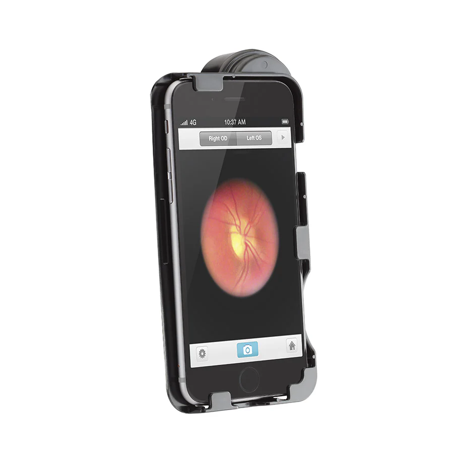 Welch Allyn iExaminor Adaptor for the iPhone 6 Plus & 6S Plus - Image 2