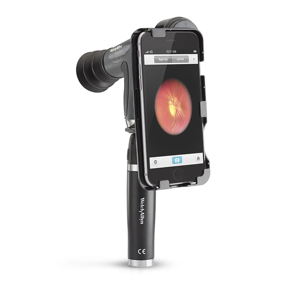 Welch Allyn iExaminor Adaptor for the iPhone 6 Plus & 6S Plus - Image 3