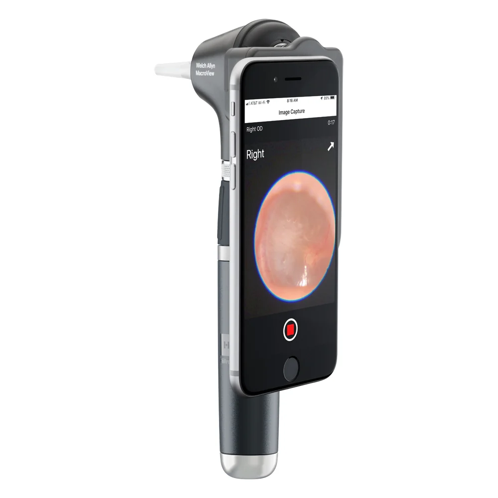 Welch Allyn MacroView Plus Otoscope 3.5v [iExaminer - Head only] - Image 4
