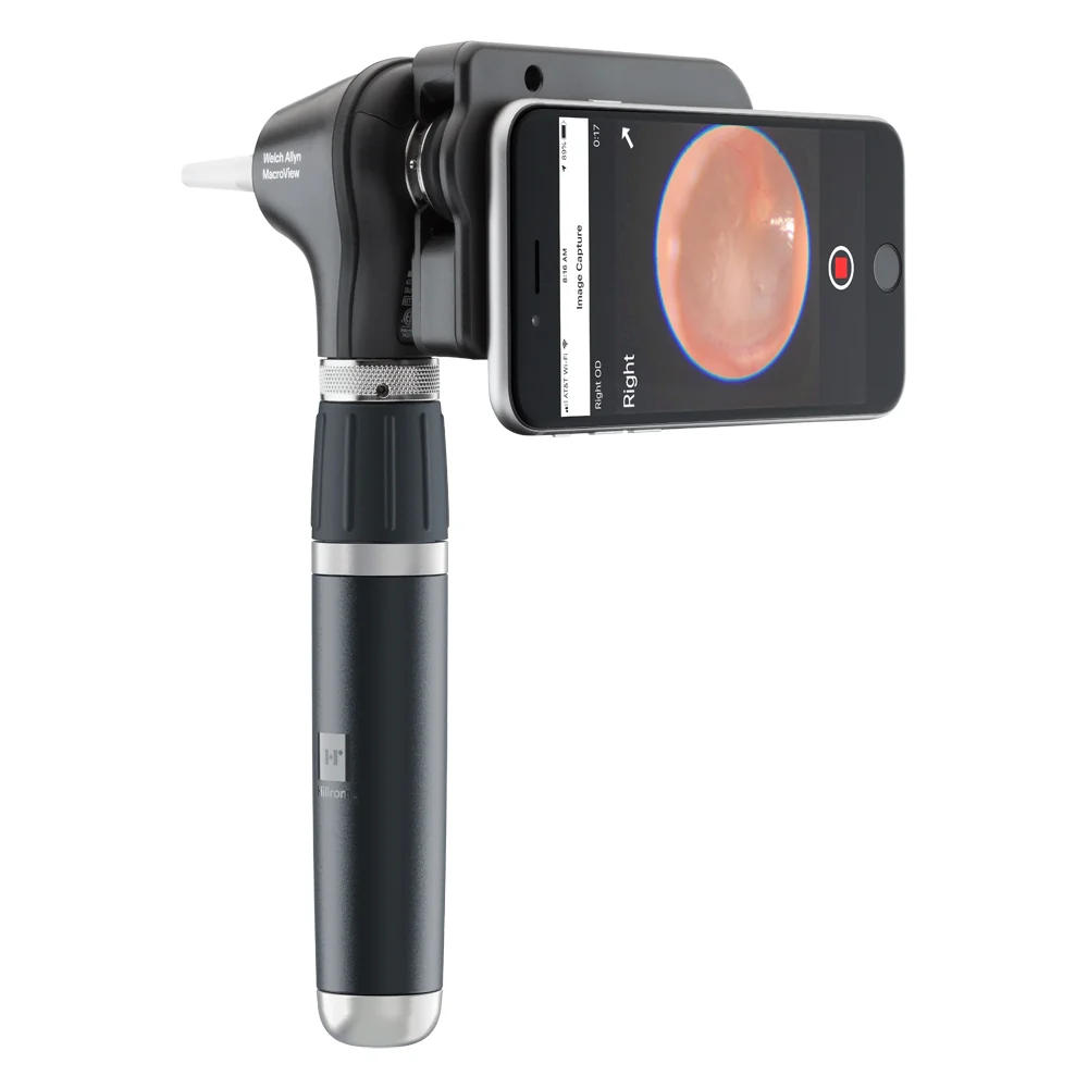 Welch Allyn MacroView Plus Otoscope 3.5v [iExaminer - Head only] - Image 5
