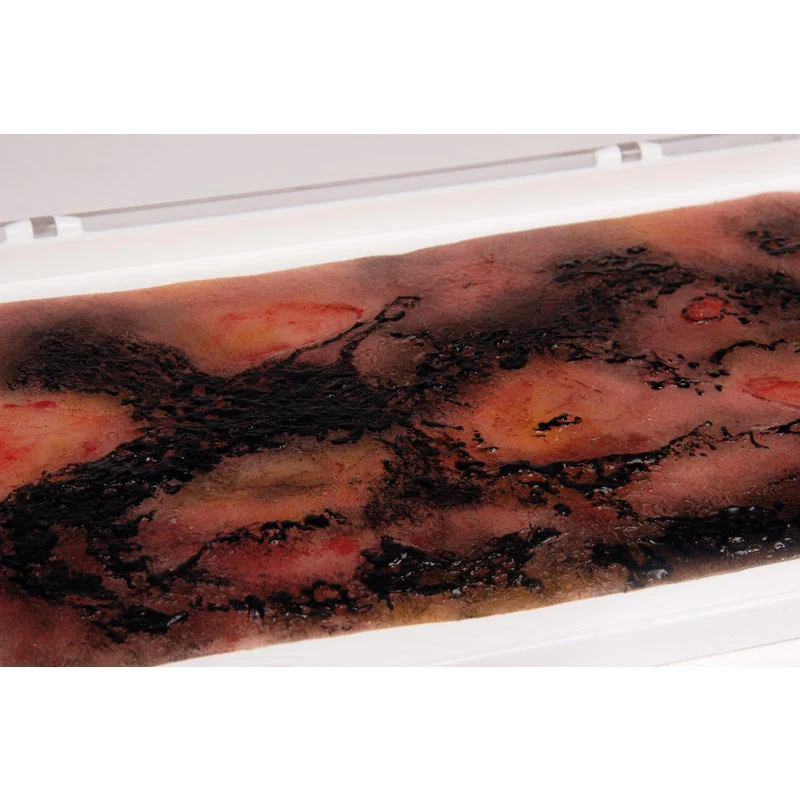 Wound Moulage 3rd Degree Burn - Large - Image 2