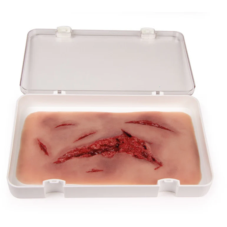 Wound Moulage "Abrasion"