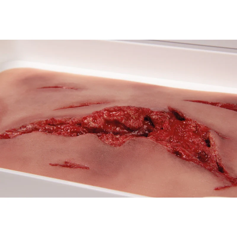 Wound Moulage "Abrasion" - Image 2