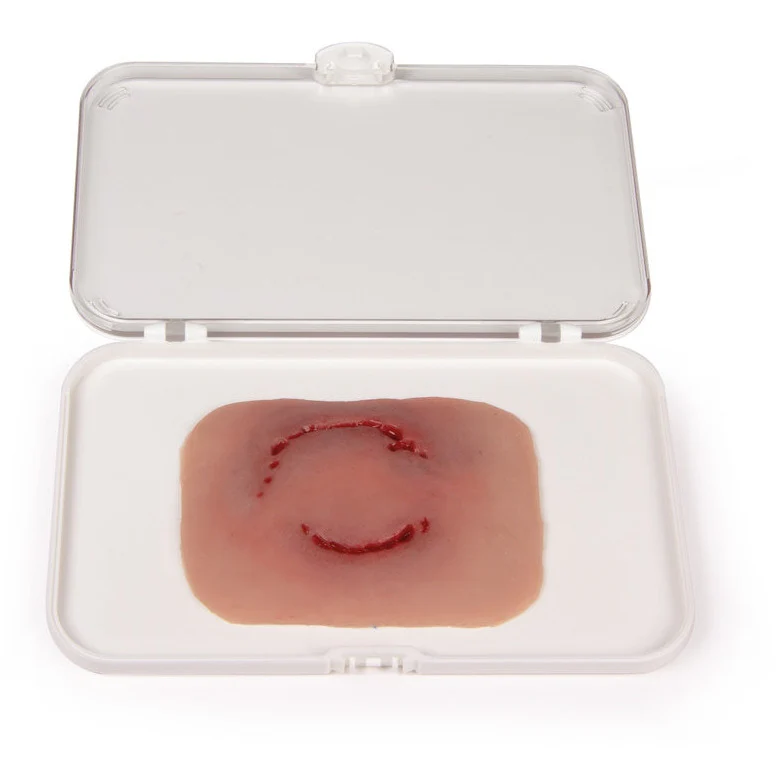 Wound Moulage "Human Bite"