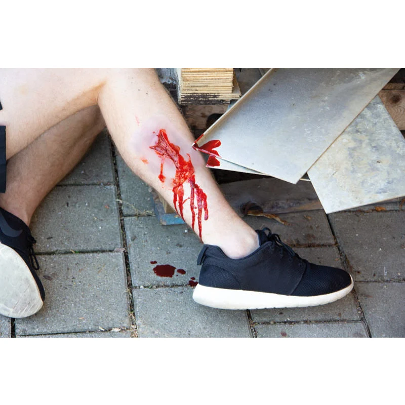 Wound Moulage "Laceration" - Image 3
