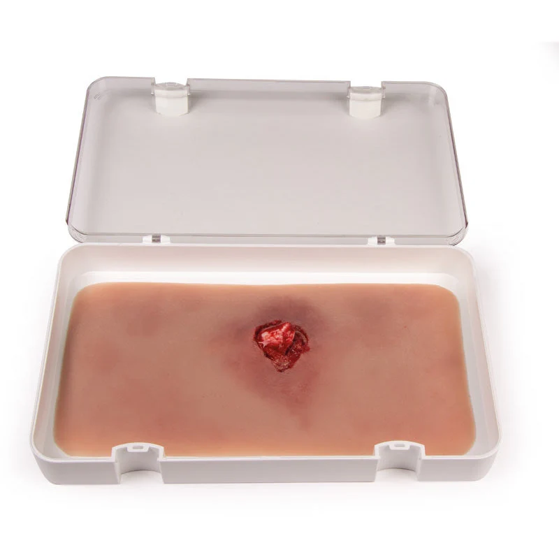Wound Moulage Open Fracture, Arm Bone With Bleeding Function