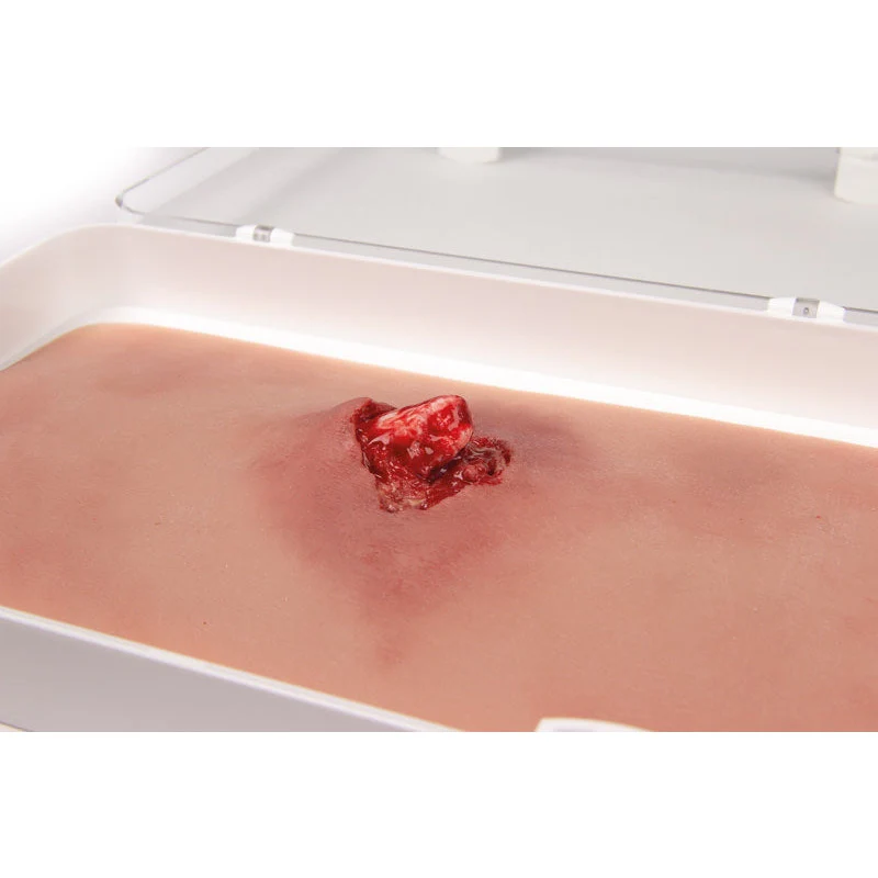 Wound Moulage Open Fracture, Arm Bone With Bleeding Function - Image 2