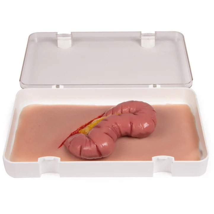Wound Moulage Protrusion Of Large Intestines