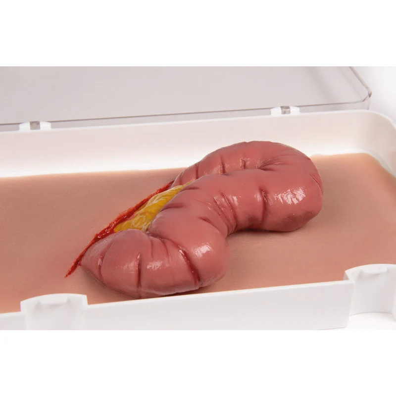 Wound Moulage Protrusion Of Large Intestines - Image 2