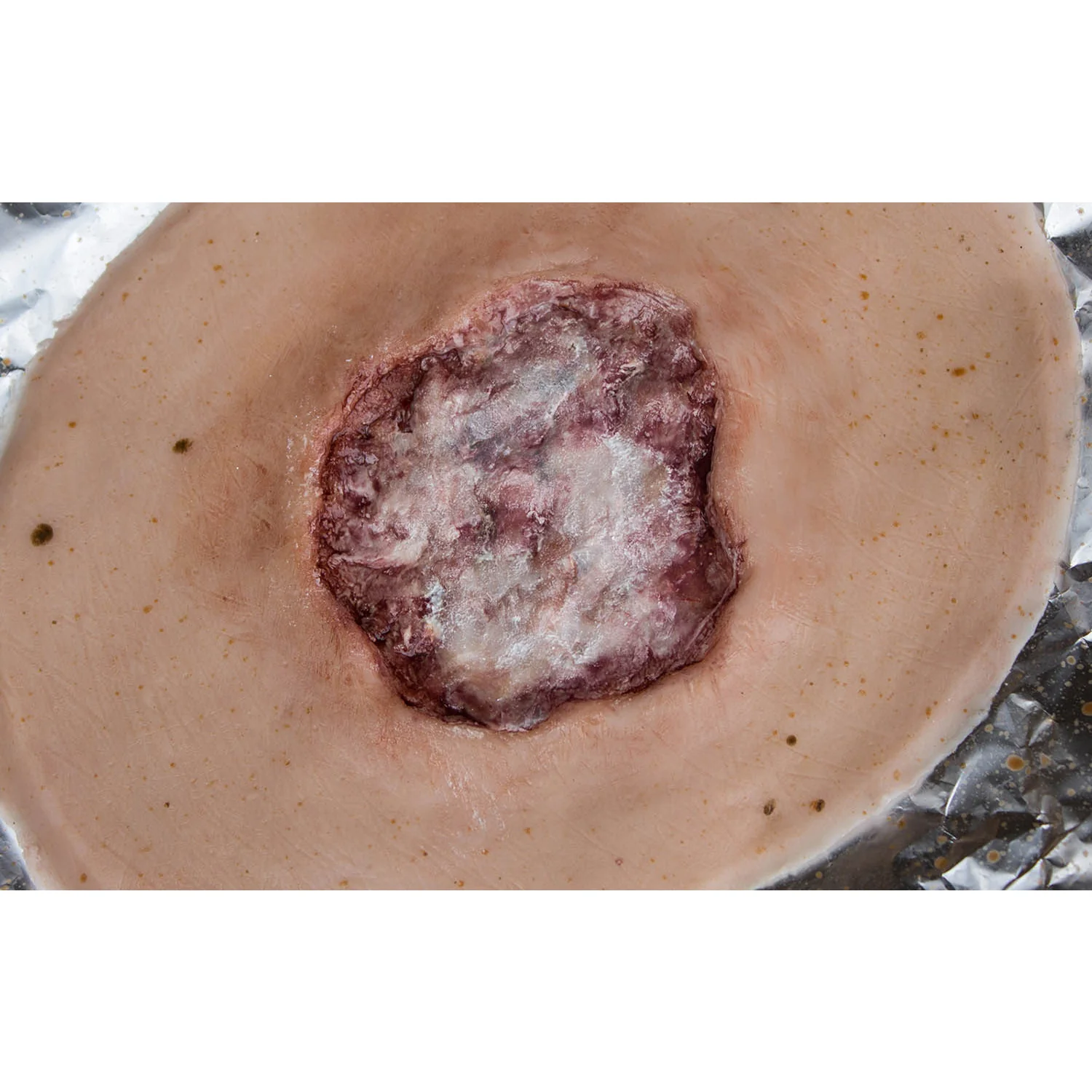 Wound with Debris - White with Cavity - Large